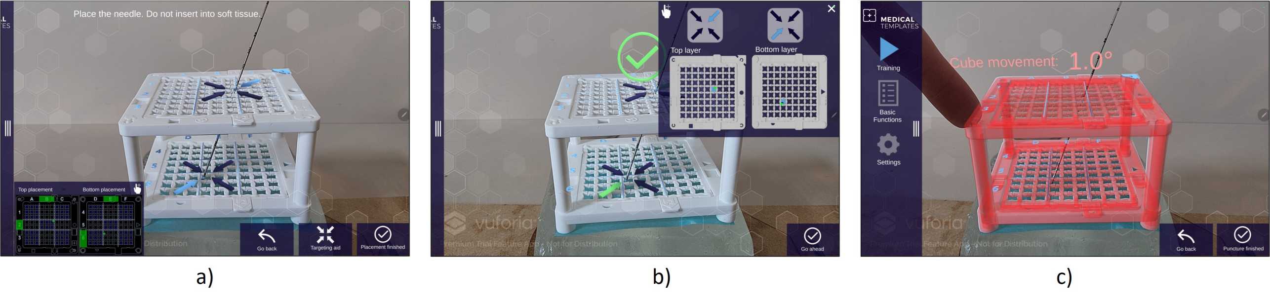 Augmented Reality Support for Interventional Radiology