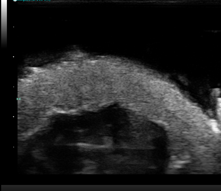 ultrasound_image